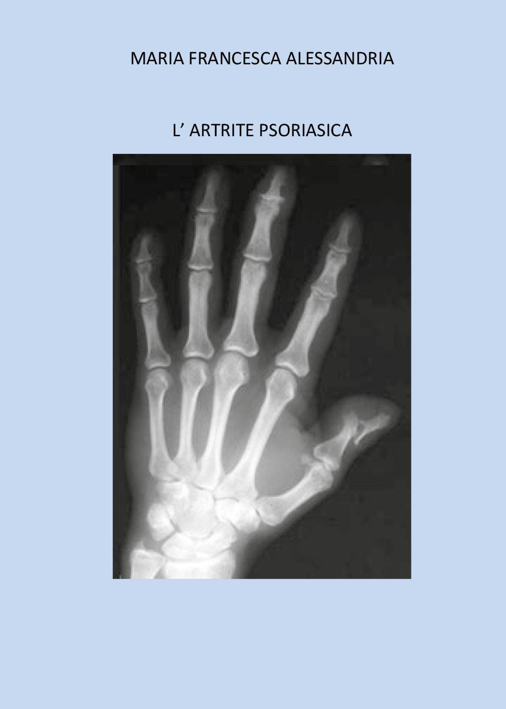 L'artrite psoriasica