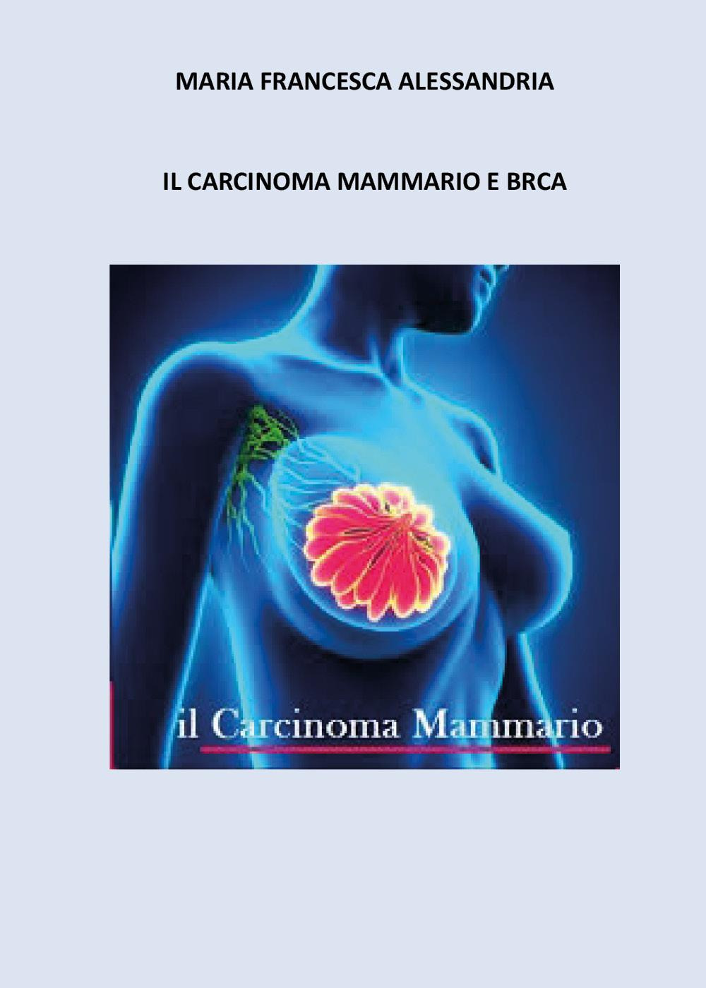 Il carcinoma mammario e BRCA