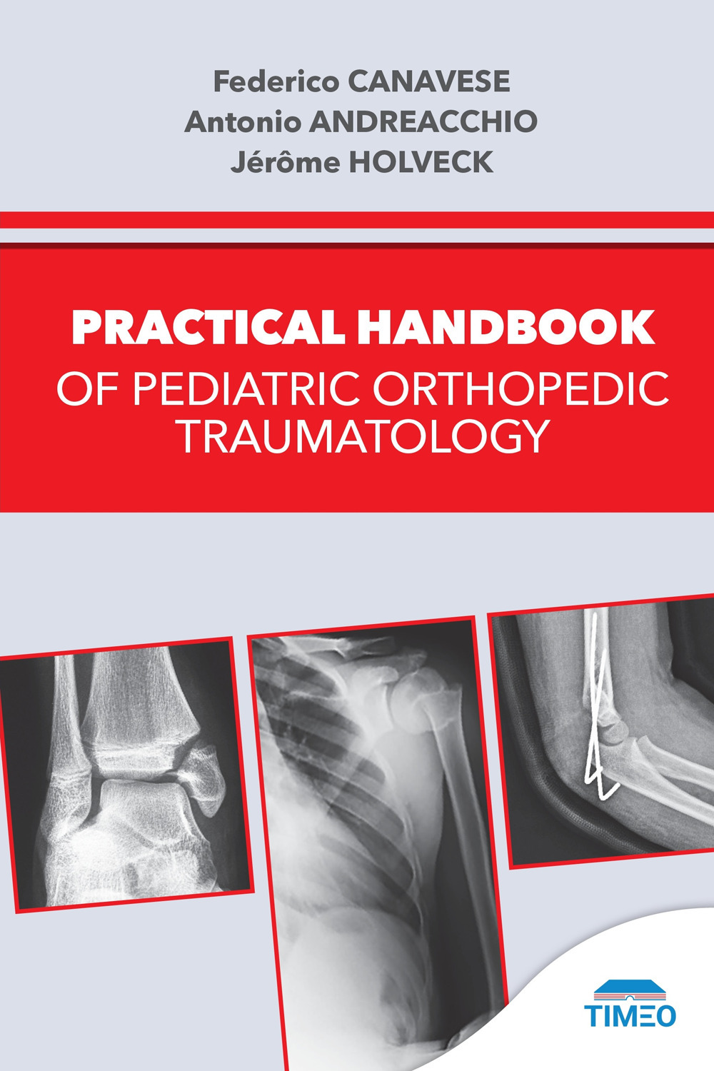 Practical handbook of pediatric orthopedic traumatology